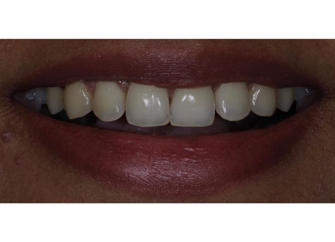 After